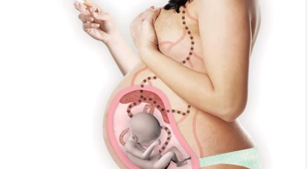 Roken tijdens je zwangerschap